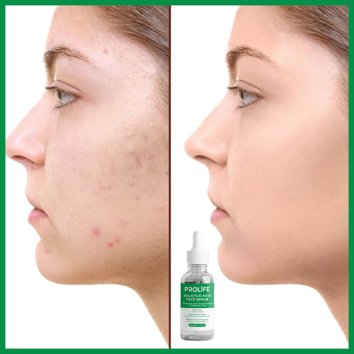 Salicylic Acid Face Serum